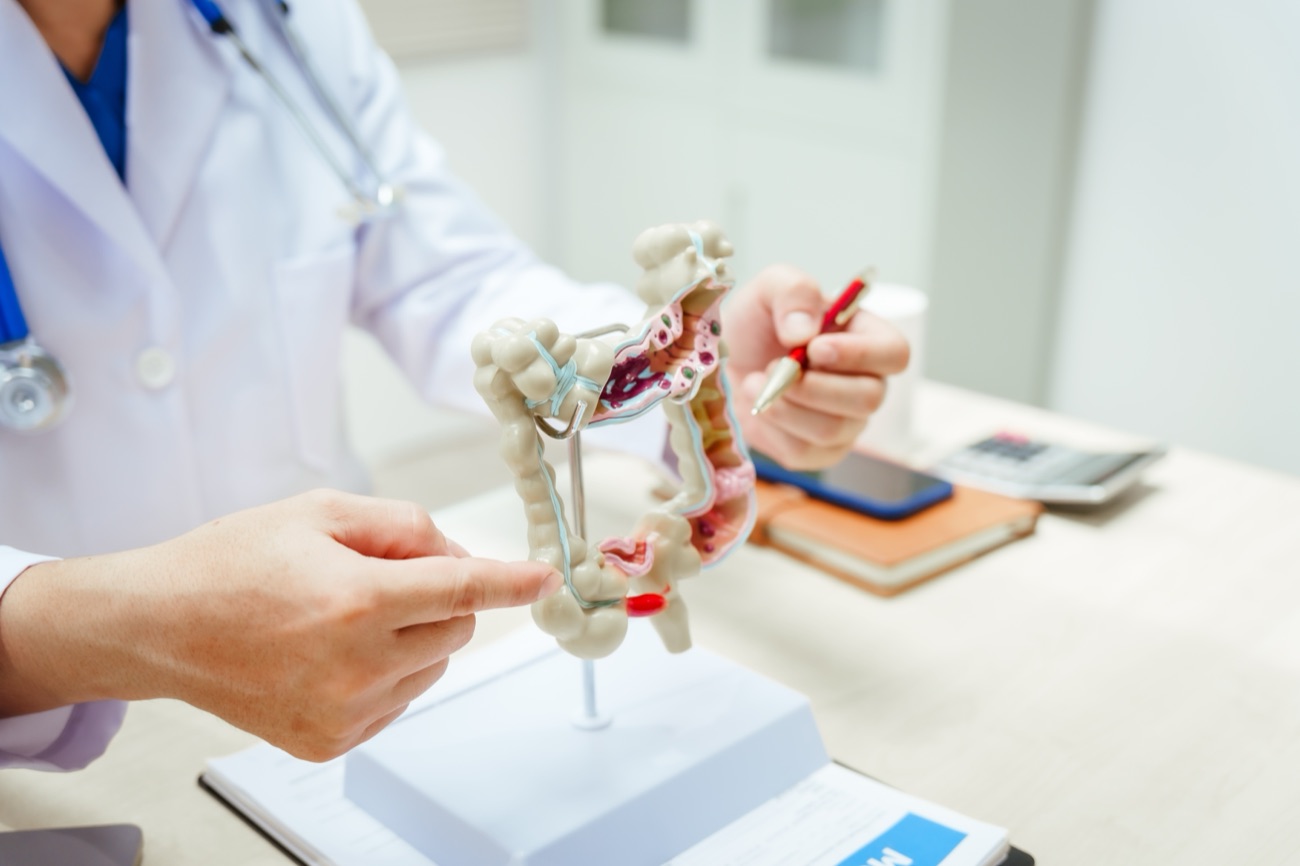 Doctor pointing to the appendix of a colon model